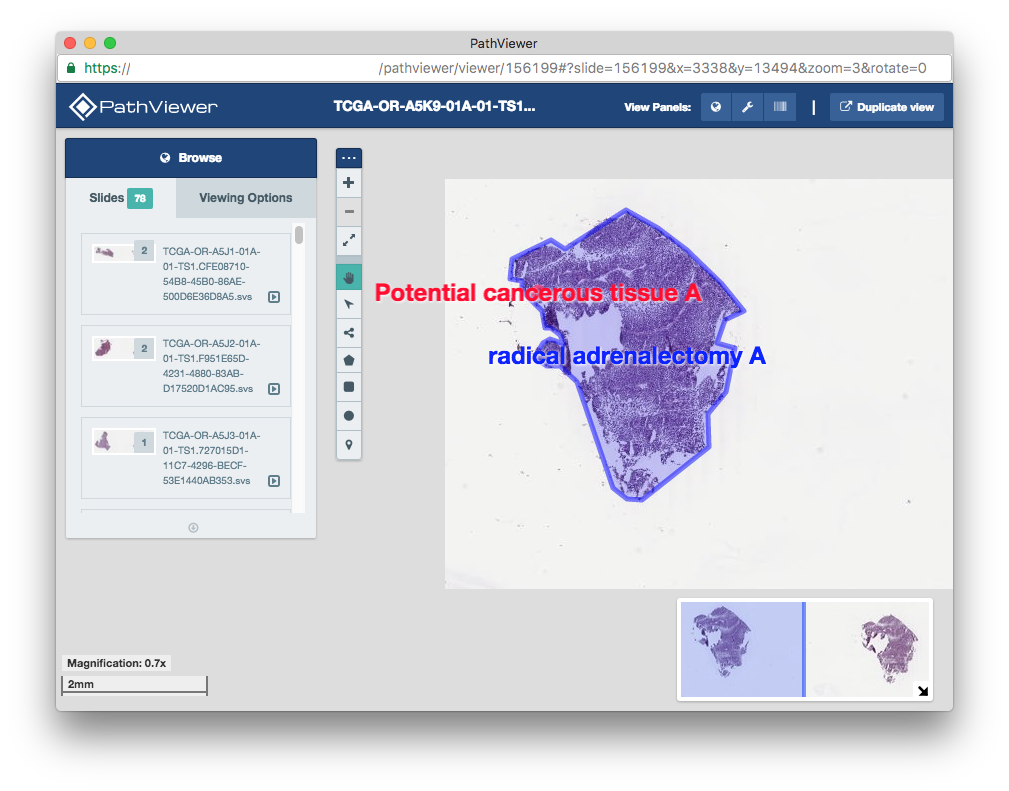 OMERO.insight compatibility — PathViewer 3.14.0 documentation